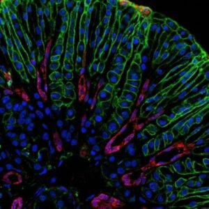 Buffer de Lavado para Inmunología
